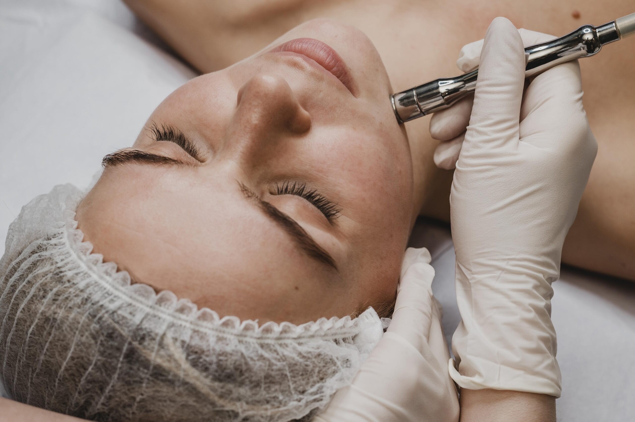 microneedling göteborg med dermapen 4